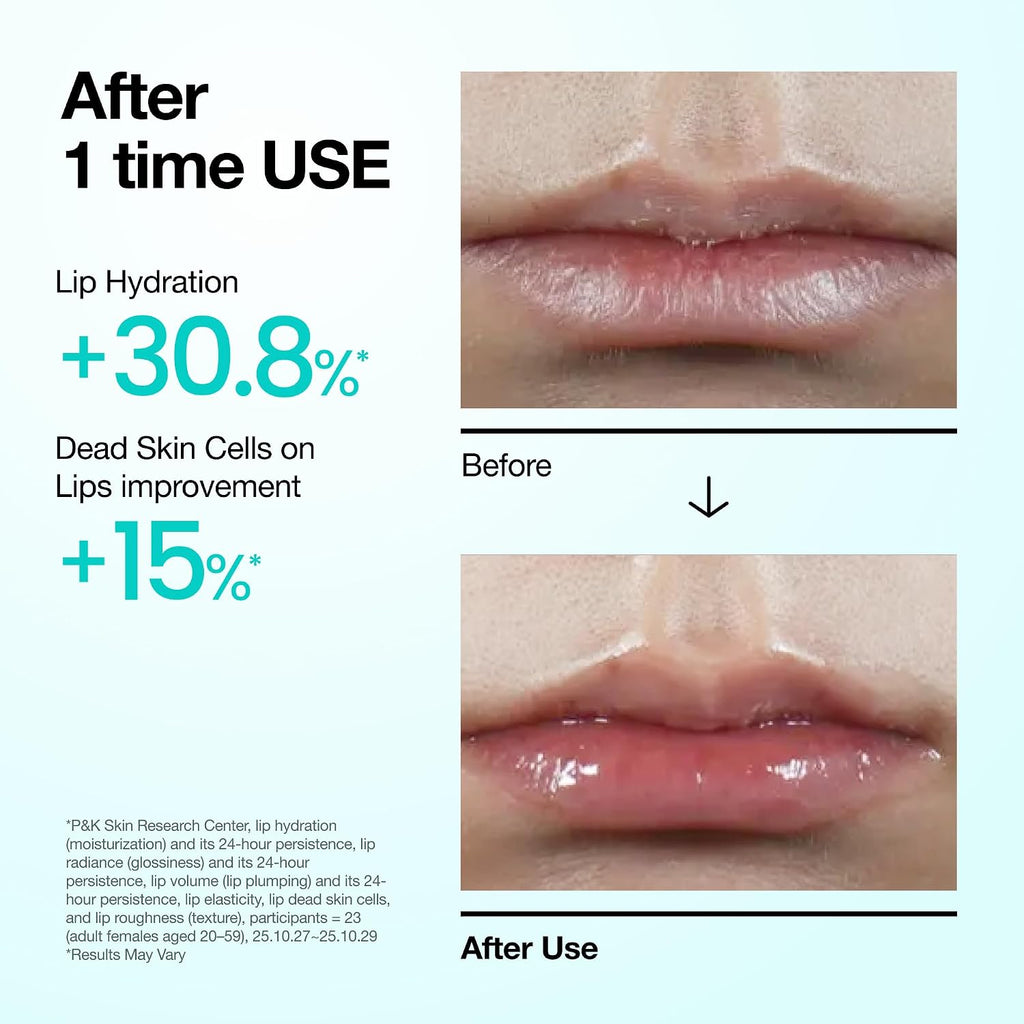 PDRN Lip Serum, 0.33 Fl.Oz | Long-Lasting Hydration for Dry Skin, Non-Sticky Moisturizing Lip Care with Salmon DNA, Hyaluronic Acid & Collagen