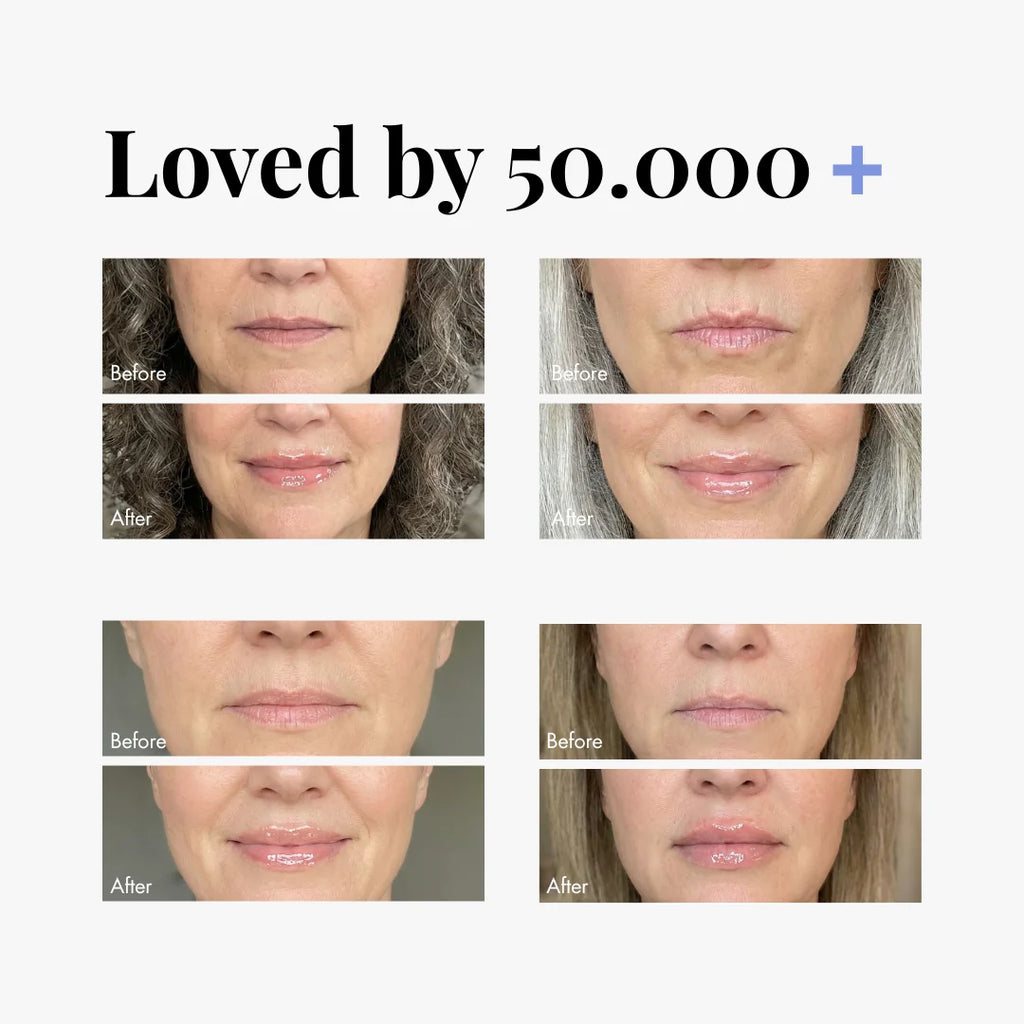 Extreme Lip Plumper