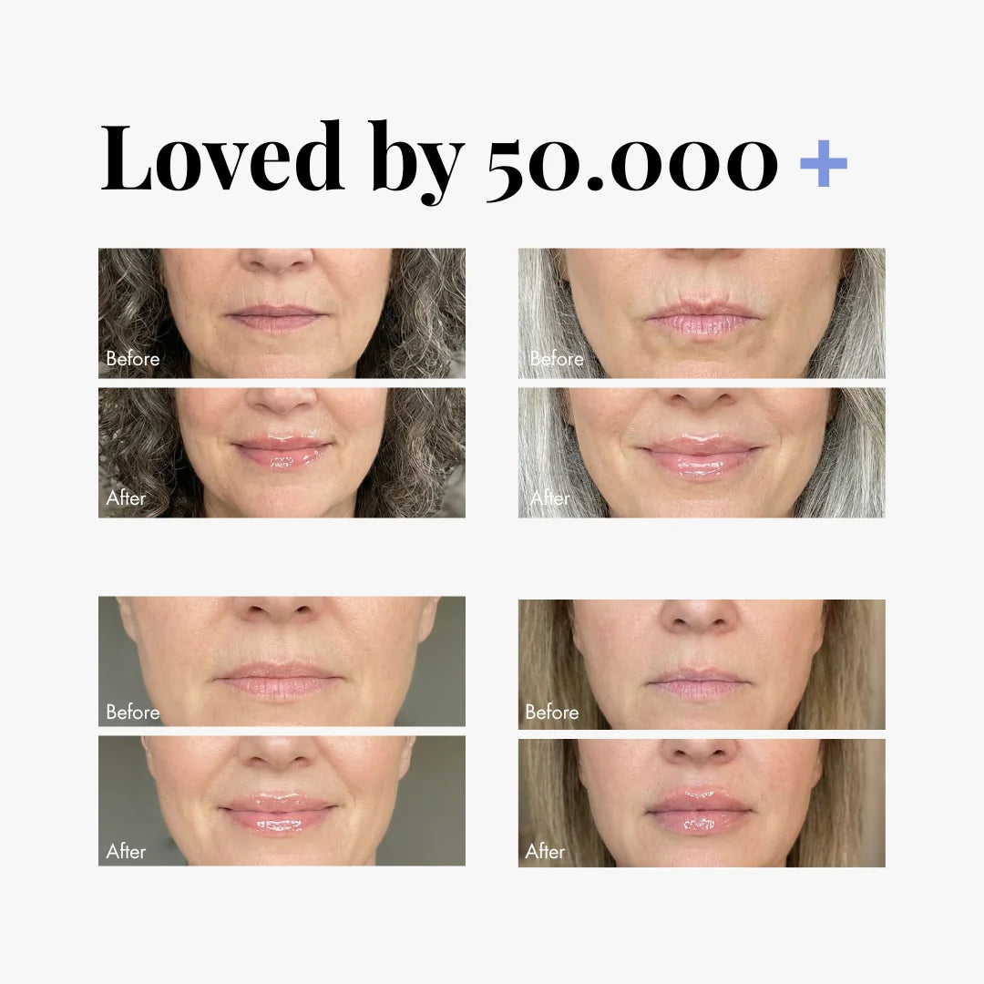 Extreme Lip Plumper